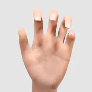 Yes