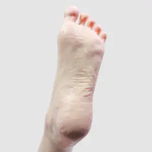 Non-Standing