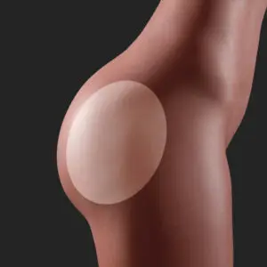 Yes